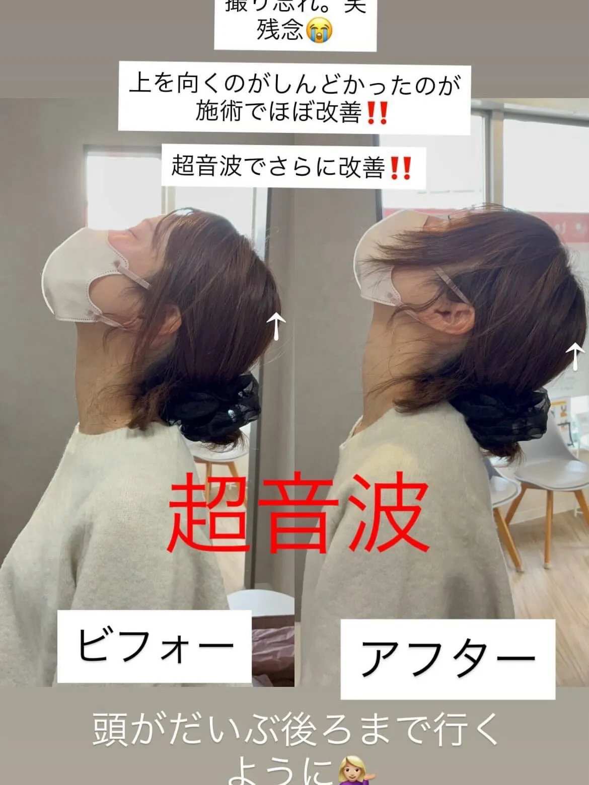 超音波治療➰